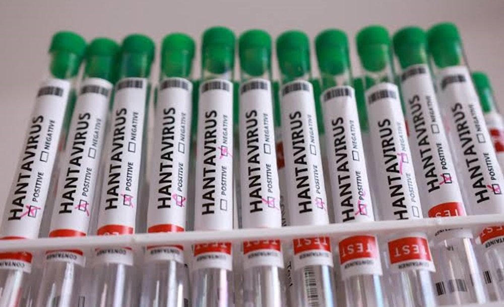 MinSalud confirma 3 muertespor hantavirus en Anzoátegui